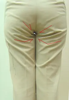 パンツの後ろ股にしわが出る原因と型紙補正